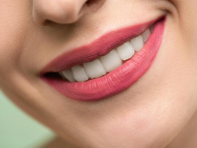 Can a Patient With Crowns or Bridges Still Get Braces?
