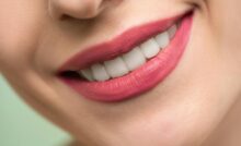 Vivid close-up image of a woman's smile showcasing red lipstick and white teeth on a light background.